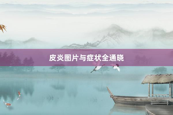 皮炎图片与症状全通晓
